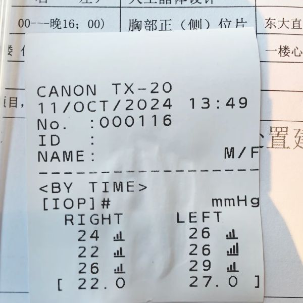 高眼压检查单 高眼压检查单