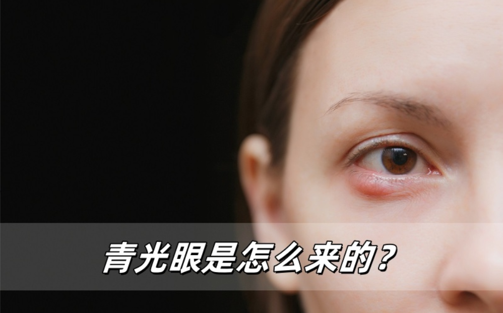 青光眼是怎么来的？九成人都不知道