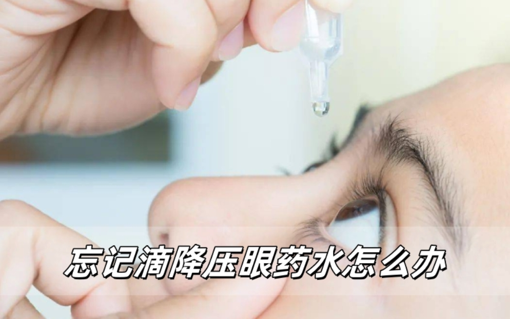 忘记滴降压眼药水怎么办？看完这篇就全明白了
